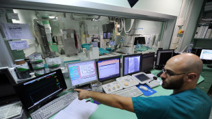 Intelligenza artificiale legge rischio cardiaco su semplice test