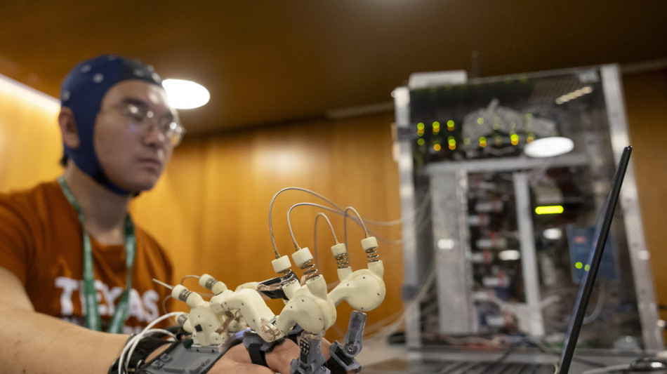 L'IA misura la velocit&agrave; con cui invecchia il cervello