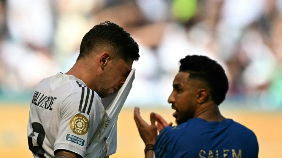 Real Madrid held by Al-Hilal in Alsonso's debut