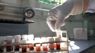 Scoperte cellule staminali nella retina, aprono a nuove terapie