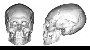 Cranio di 12.000 anni svela pratica intenzionale di deformazione
