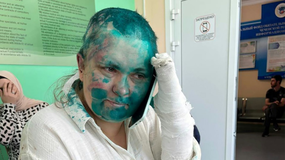 Russie: une journaliste d'investigation pass&eacute;e &agrave; tabac en Tch&eacute;tch&eacute;nie