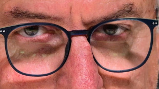 Sele&ccedil;&atilde;o de Dorival J&uacute;nior inicia 'reformula&ccedil;&atilde;o' em meio a desfalques
