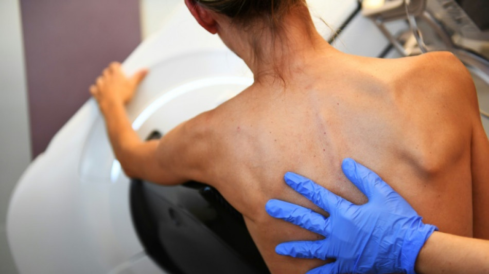 Cancers du sein, colorectal, du col de l'ut&eacute;rus: mettre les bouch&eacute;es doubles pour d&eacute;pister en France