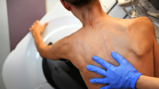 Mammografiescreening ab Juli auch f&uuml;r Frauen bis 75 Jahre m&ouml;glich