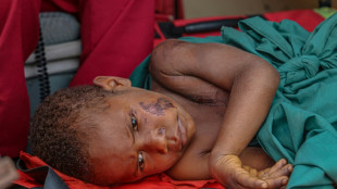 Voluntarios en esfuerzo desesperado por llegar a v&iacute;ctimas de terremoto en Pap&uacute;a