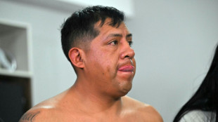 La Polic&iacute;a de Ecuador captura al l&iacute;der de la mafia que controlaba Quito
